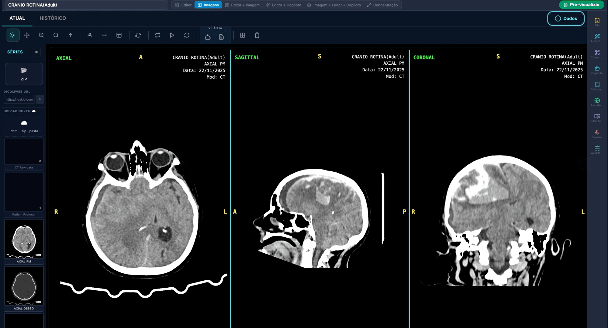 Viewer DICOM com reconstrução multiplanar em 3 viewports